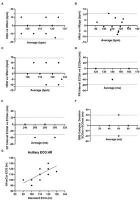 Comparison of Standard Electrocardiography and Smartphone-Based Electrocardiography Recorded at Two Different Anatomic Locations in Healthy Meat and Dairy Breed Does